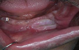 AWT IMAGE